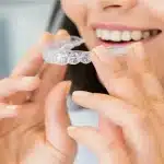 Invisalign Treatment