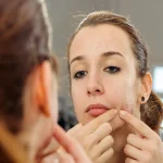 Azelaic Acid for Clearer, Brighter Skin