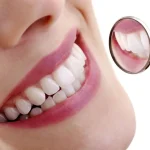 Unveiling a Brighter Smile: Five Essential Facts About Teeth Whitening Brighter Smile