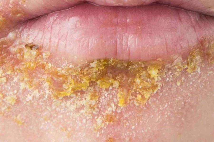 Unique Skin