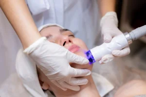 Skin Tightening