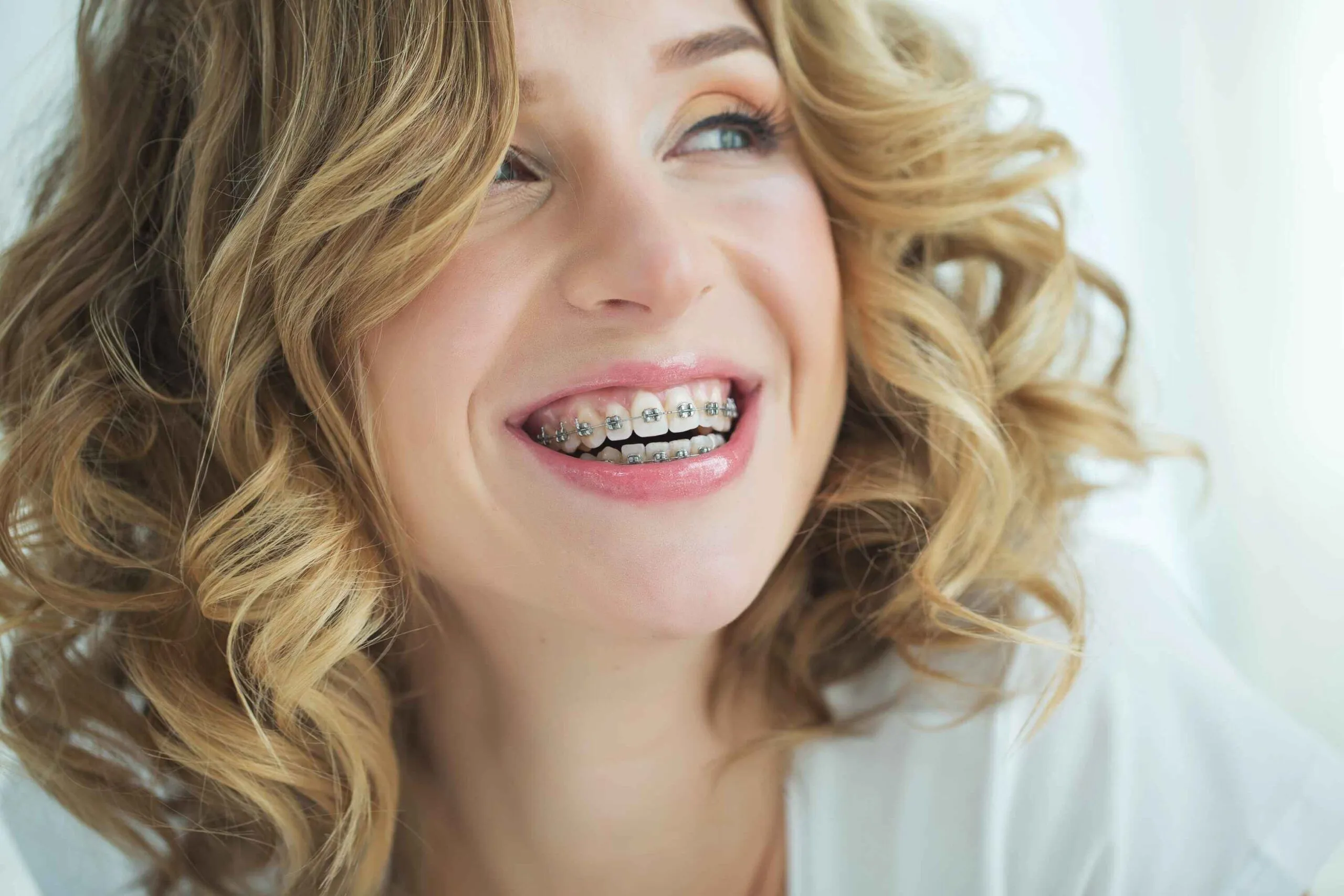 Adult Orthodontic Treatment